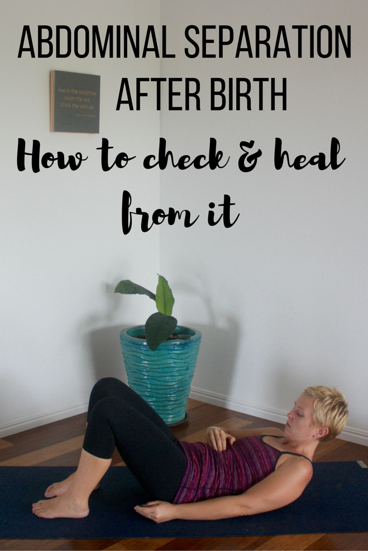 How do you know if you have abdominal separation and how to heal from it after birth.